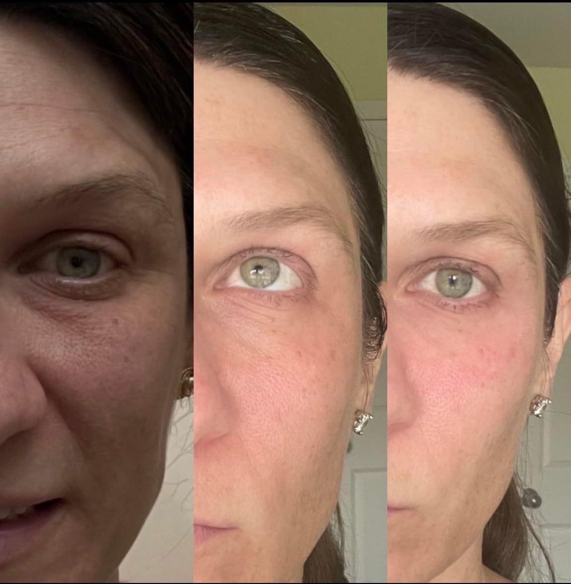 Customer photo review of NoaPure Instant Eye Lift Gel | Göz Çevresi Bakım Jeli