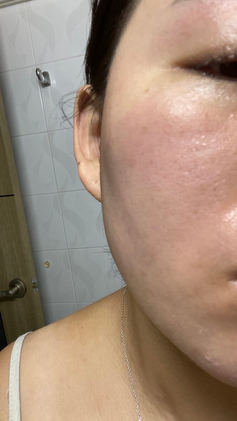 Customer photo review of eple:me Hydra Cell Boosting Toner 400ml