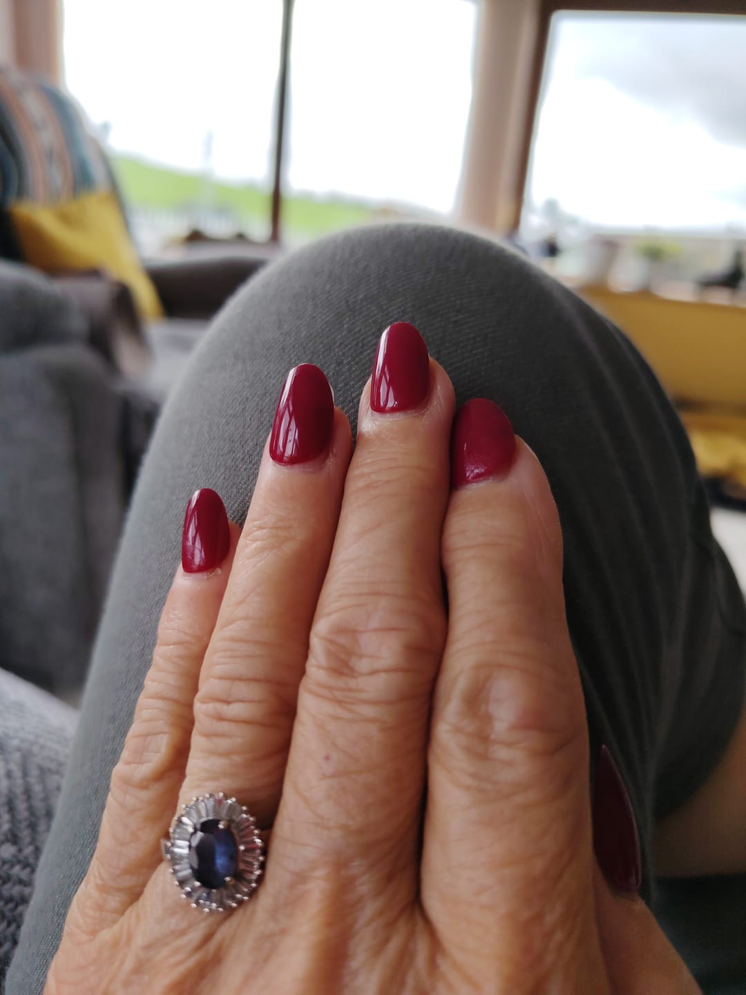 Customer photo review of Nail Glue