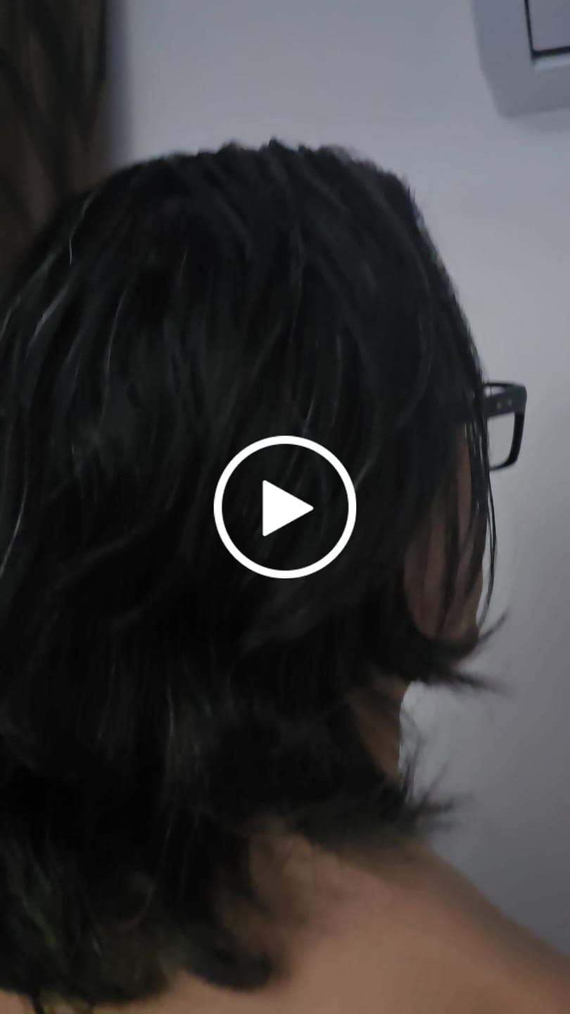 Customer video review of Minoxidil 5 mg con 90 tabletas para 3 meses de tratamiento