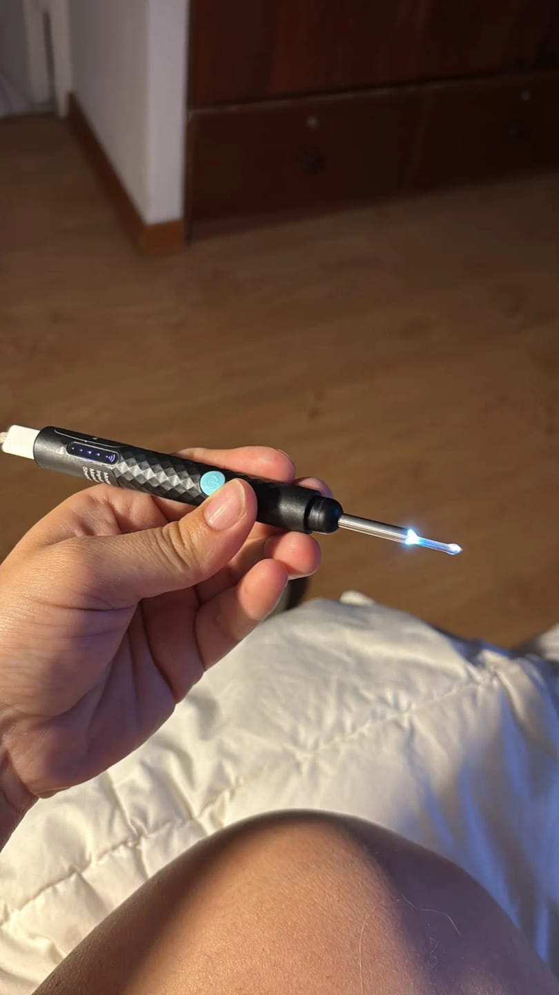 Customer photo review of AllAboutEars – 1080P Connected Otoscope, WiFi Ear Camera (iOS & Android)