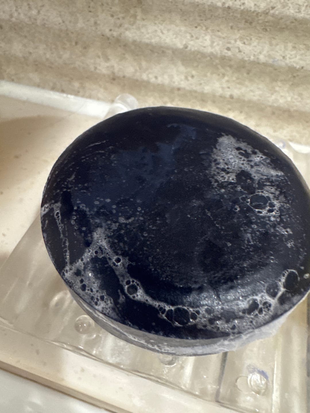Customer photo review of papasoap Deep Clean Blemish-Care Bar 100g
