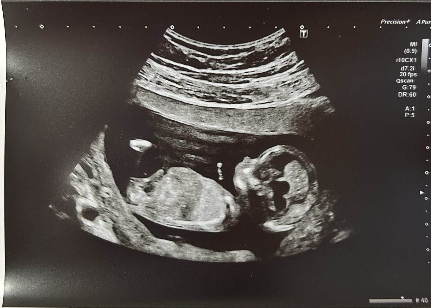 Customer photo review of Liposomal Pregnancy Support Formula