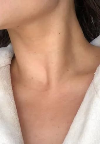 Customer photo review of 7-Color Beauty Device for Face and Neck