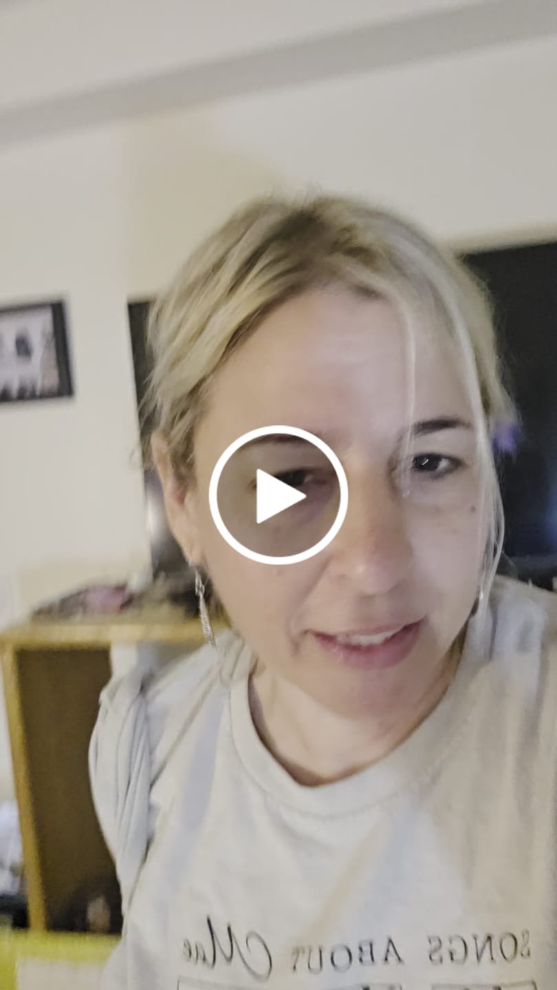 Customer video review of Silver Bohemian Hoop Dangles Hypoallergenic Earrings for Sensitive Ears with Plastic Posts
