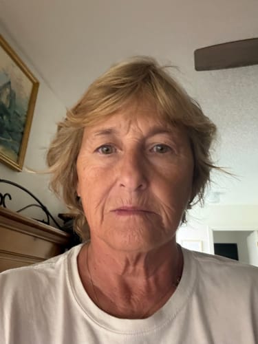 Customer's portrait six days after using Koriderm Time Reverse Cream, showing clear, healthy skin.