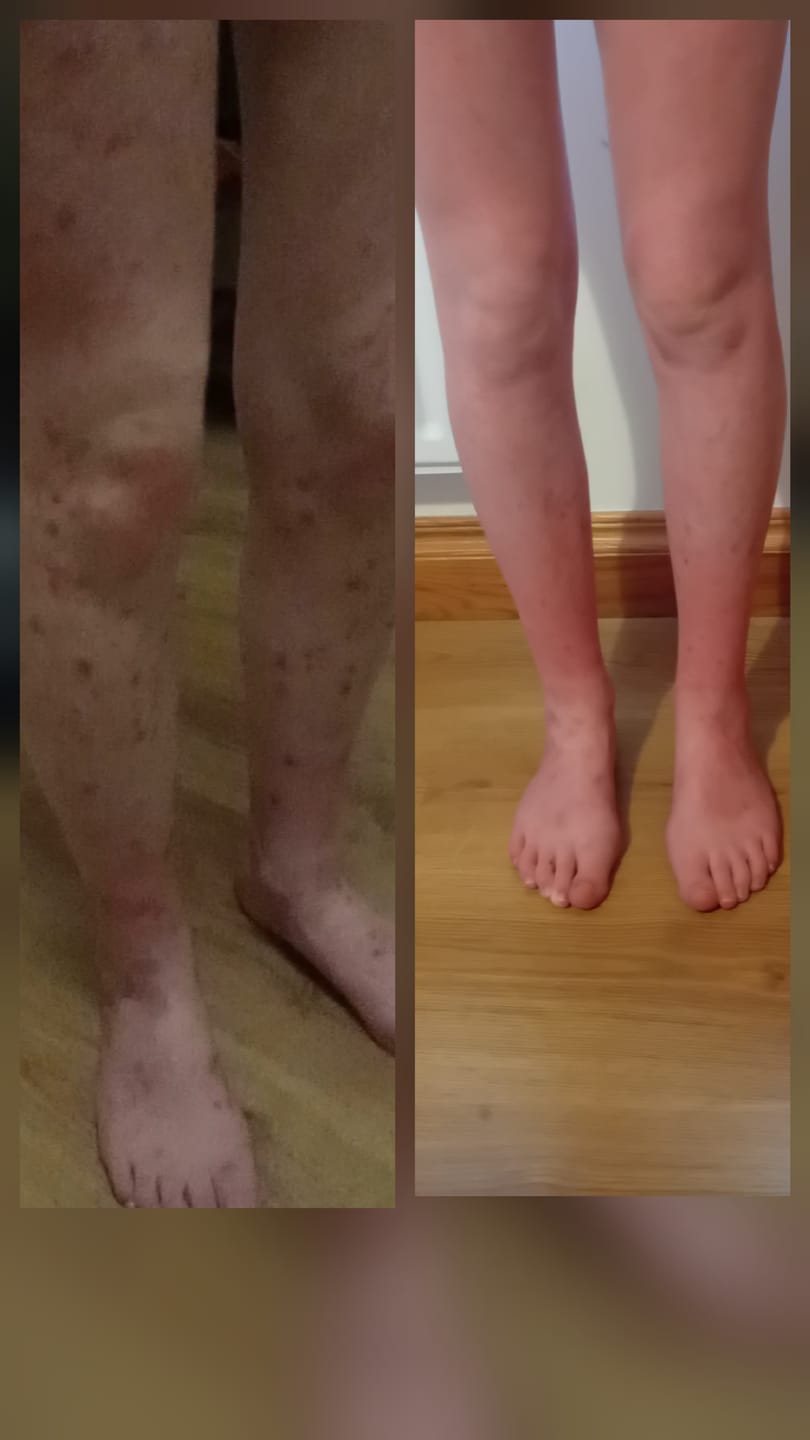 Customer photo review of Large Bioskin Junior Duo Pack