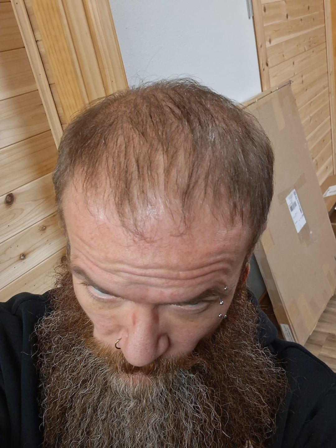 Customer photo review of Spartan™ Root Activator Shampoo 3 Bottles(sc)