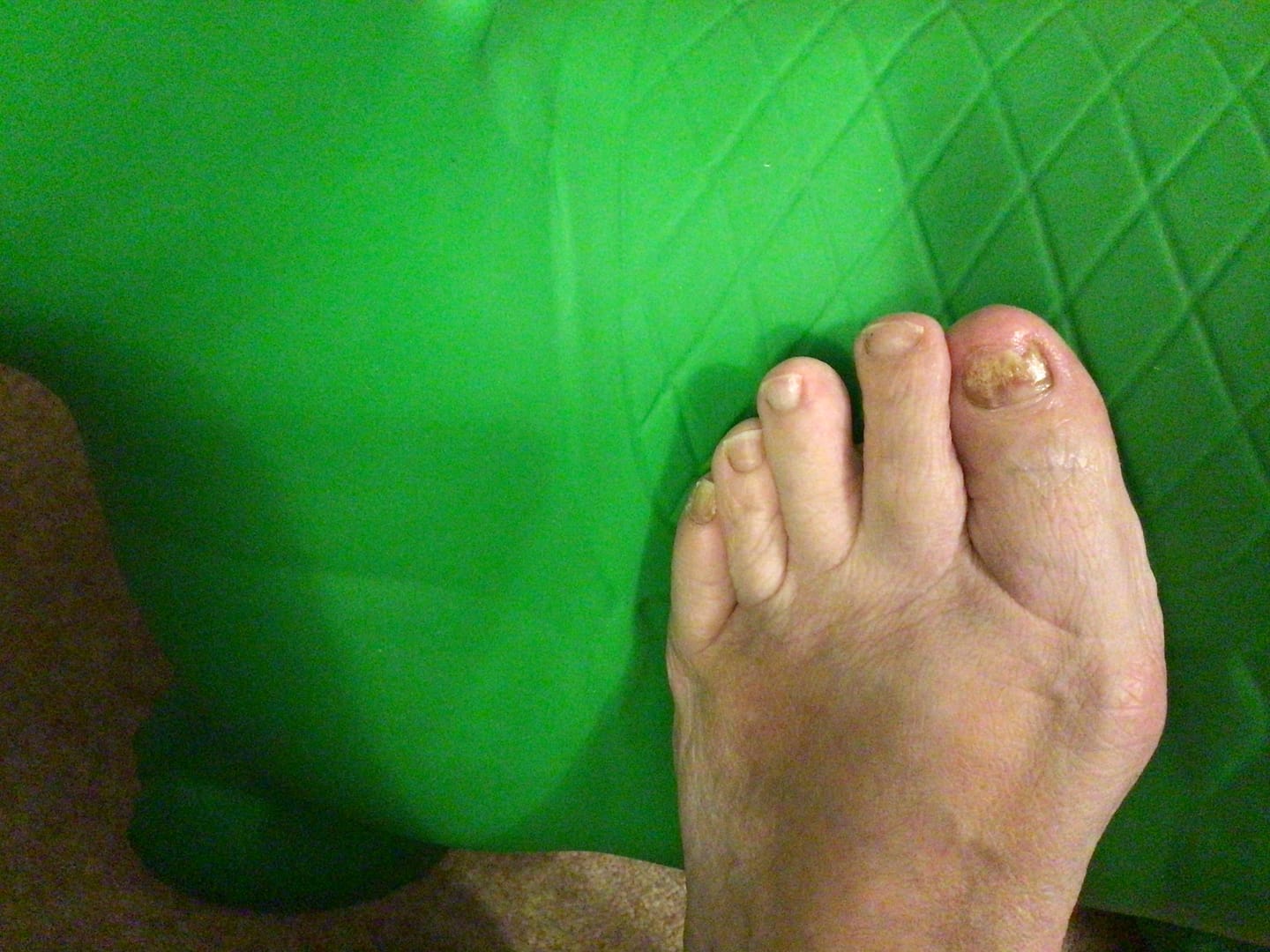 Customer photo review of Fungal Freedom