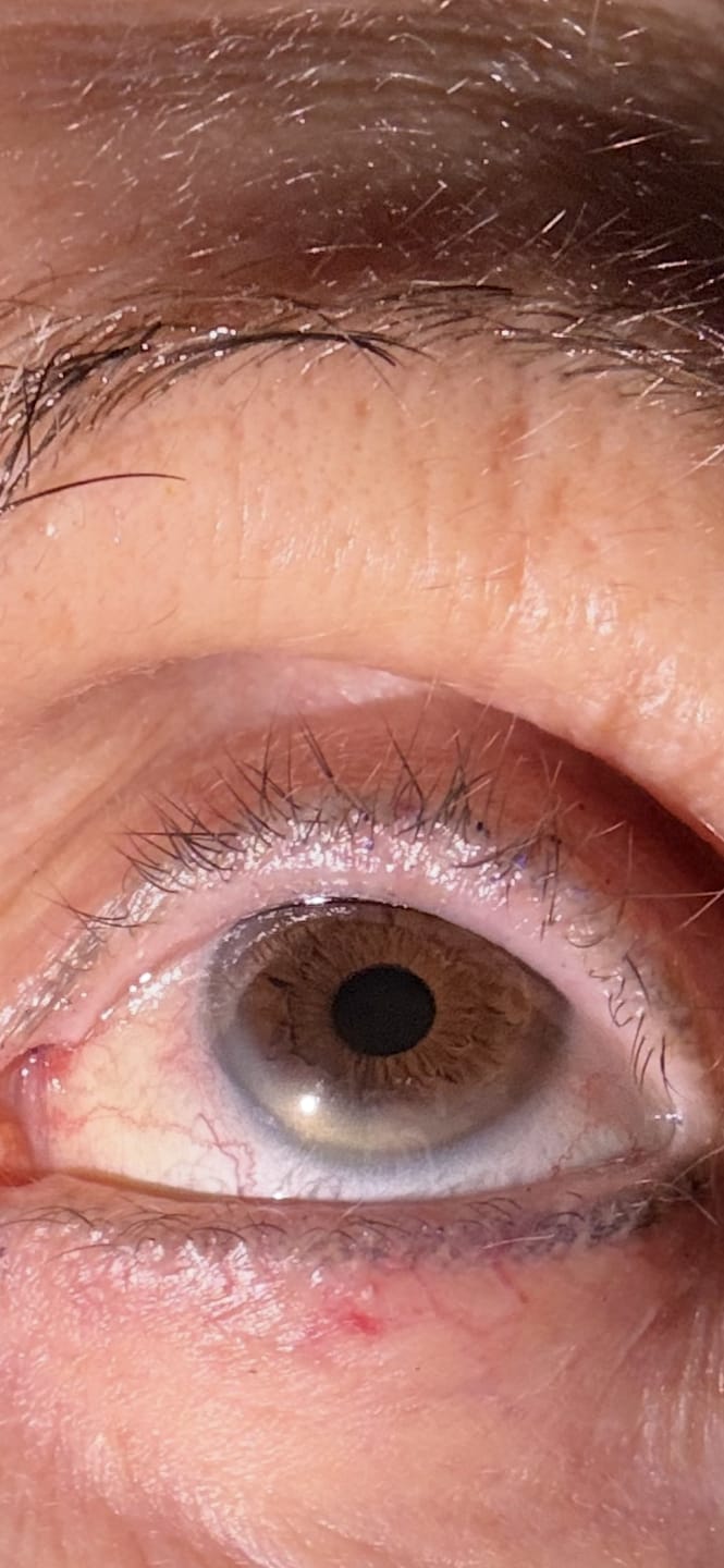 Customer photo review of Eyelash Serum