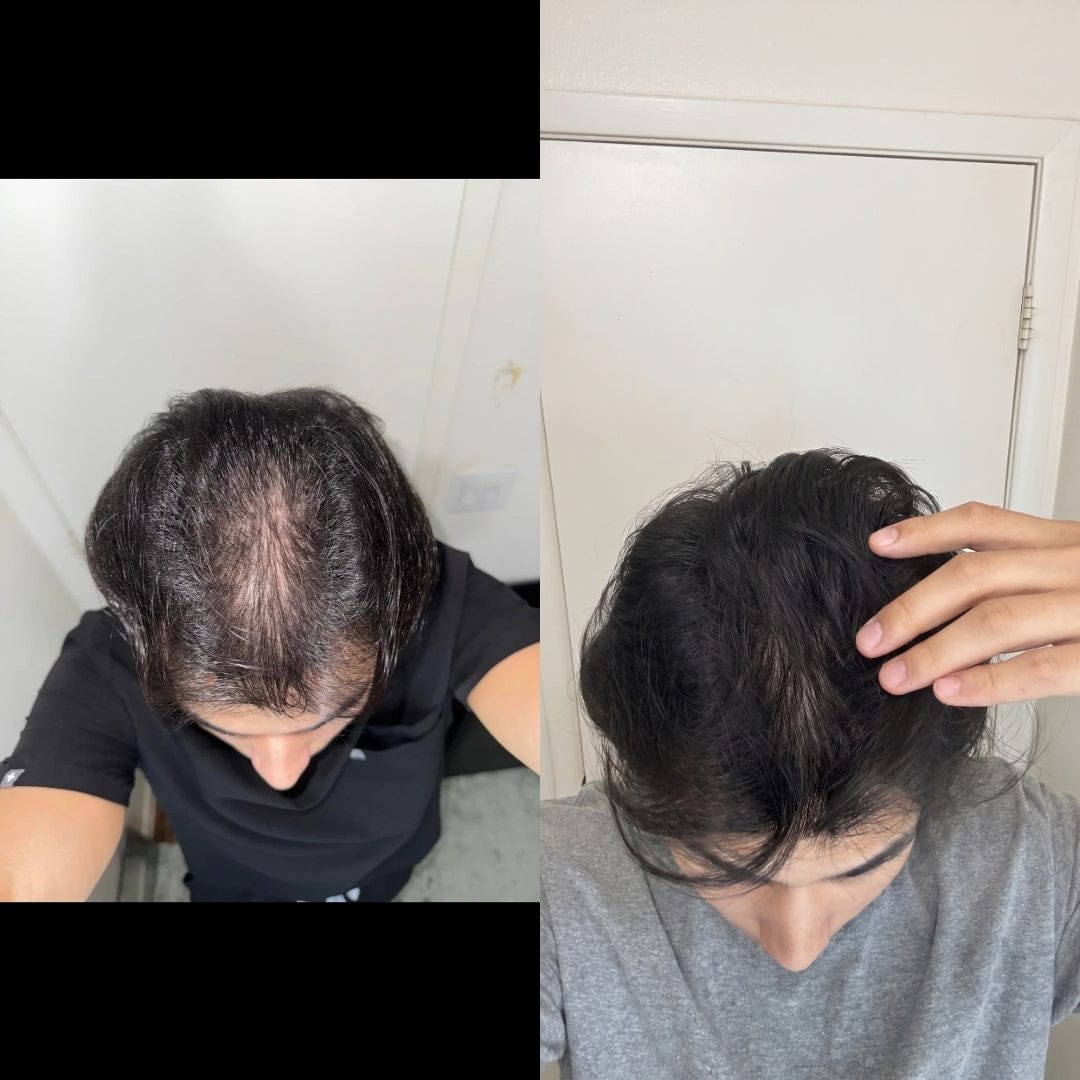 Customer photo review of Serum Anticaída para hombres y mujeres Hair Biolabs™