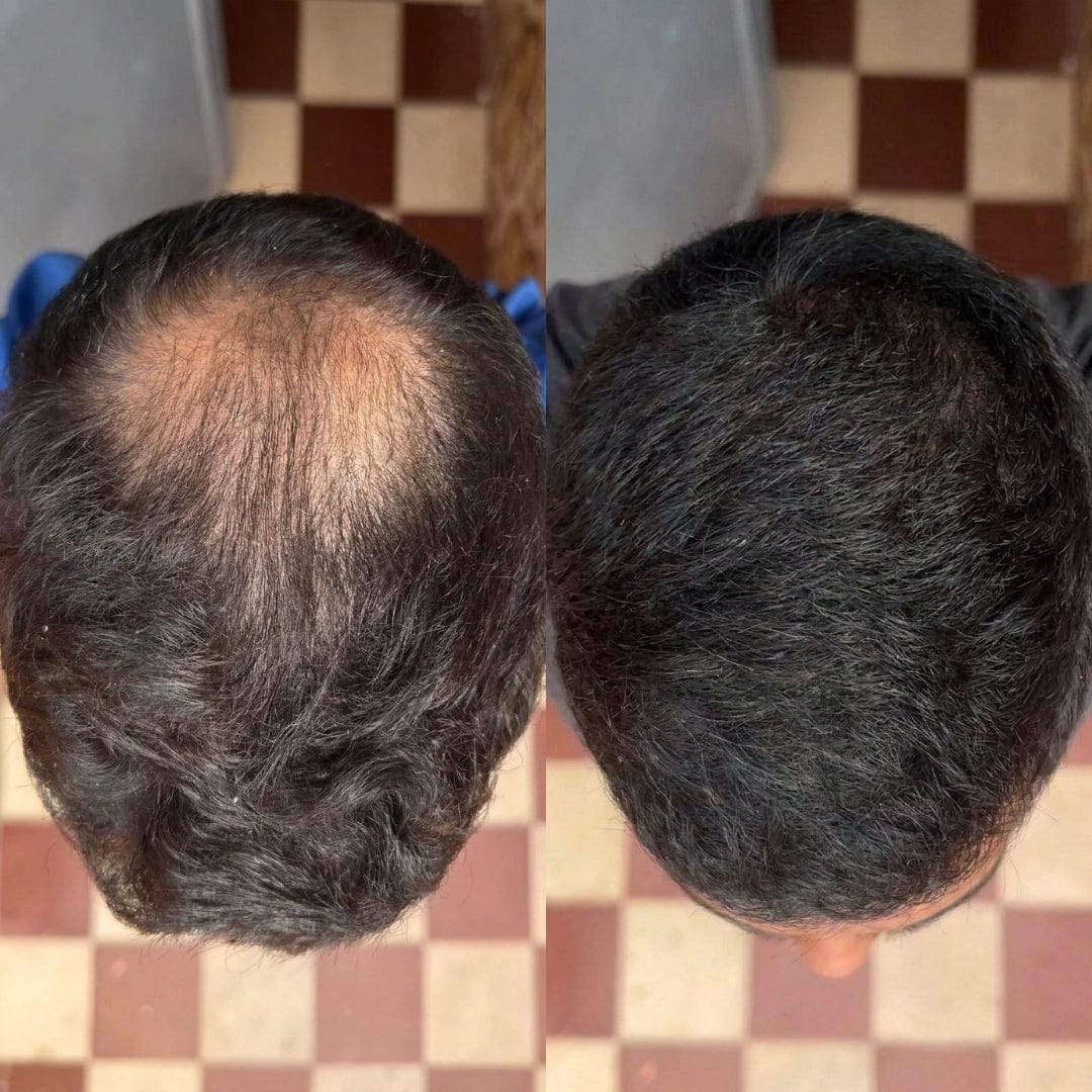 Customer photo review of Serum Anticaída para hombres y mujeres Hair Biolabs™