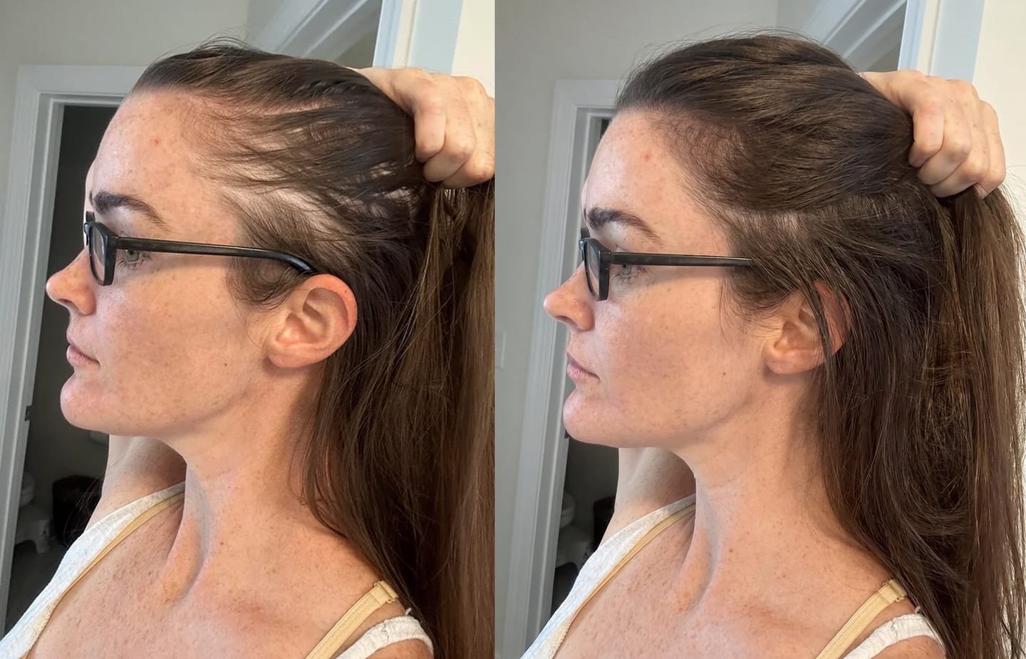 Customer photo review of Serum Anticaída para hombres y mujeres Hair Biolabs™