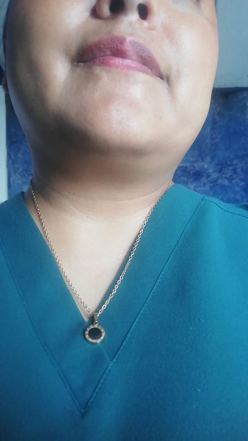 Customer photo review of Collar Medalla