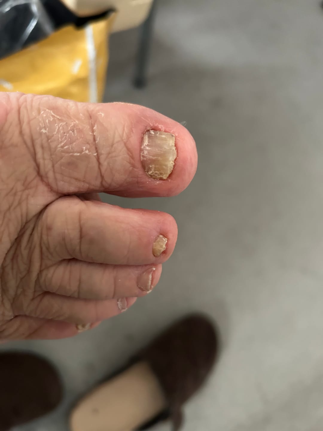 Customer photo review of Fungal Freedom