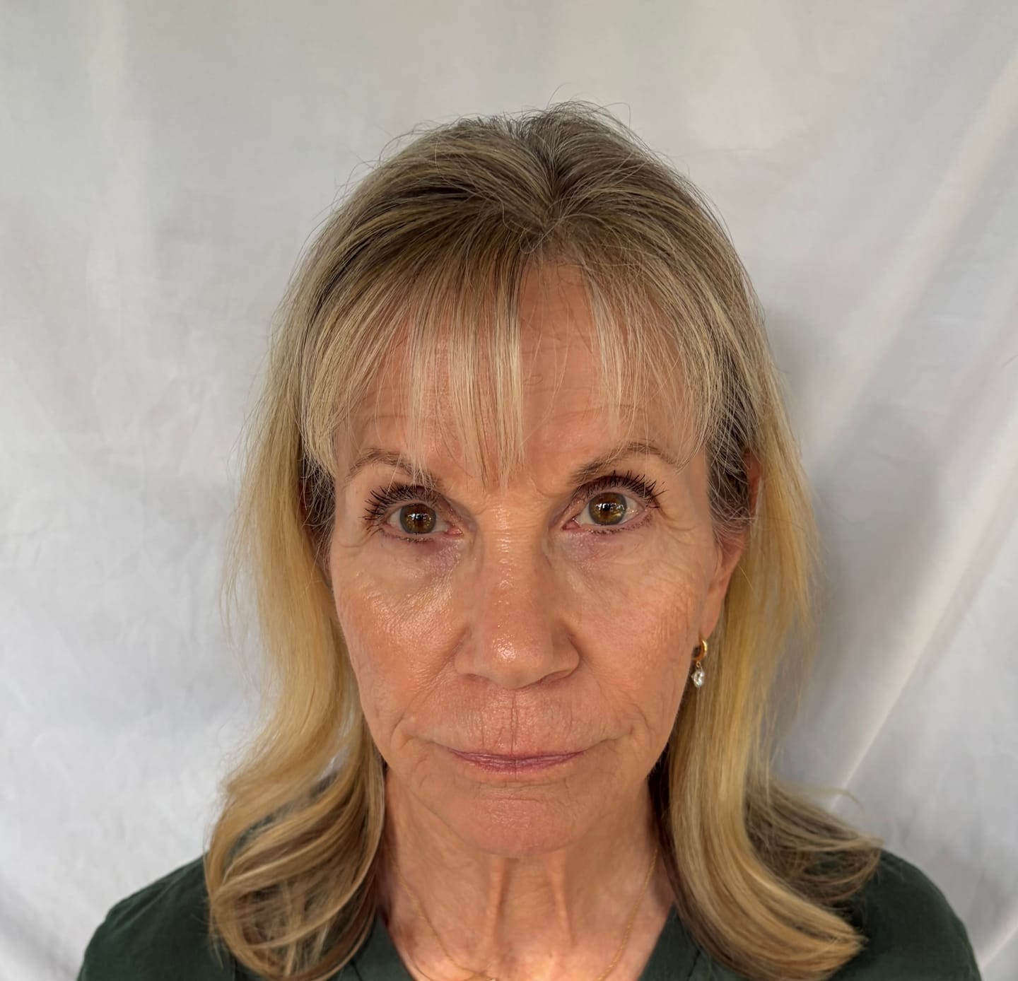 Customer photo review of ACTIVE PRO SERUM | ANTI-AGING