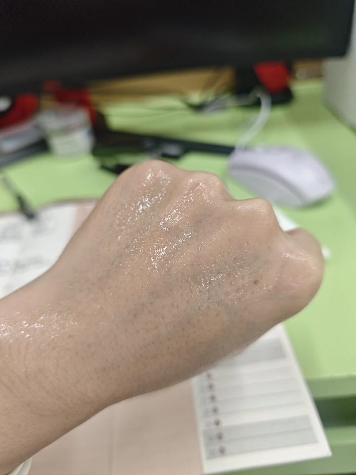 Customer photo review of TAFITIE Professional Ultrasound Conductive Gel