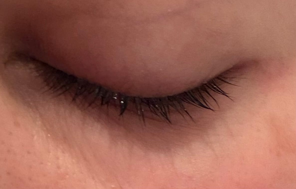 Customer photo review of Glassskinmask® - 1er Pack - Hydrogel Gesichtsmaske für strahlende Haut