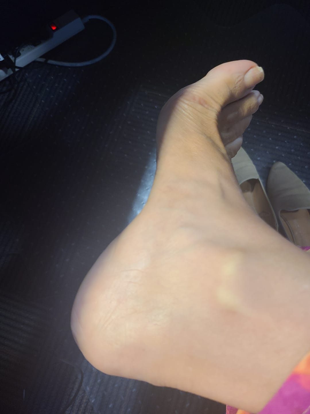 Customer photo review of Foot Balm