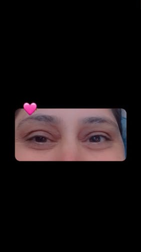 Customer's eyes showing skin texture after using the Essense Brightening Facewash, close-up view.