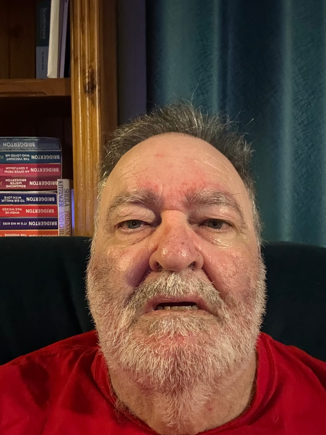 Customer photo review of Pure Organic Grass-Fed Beef Tallow Balm