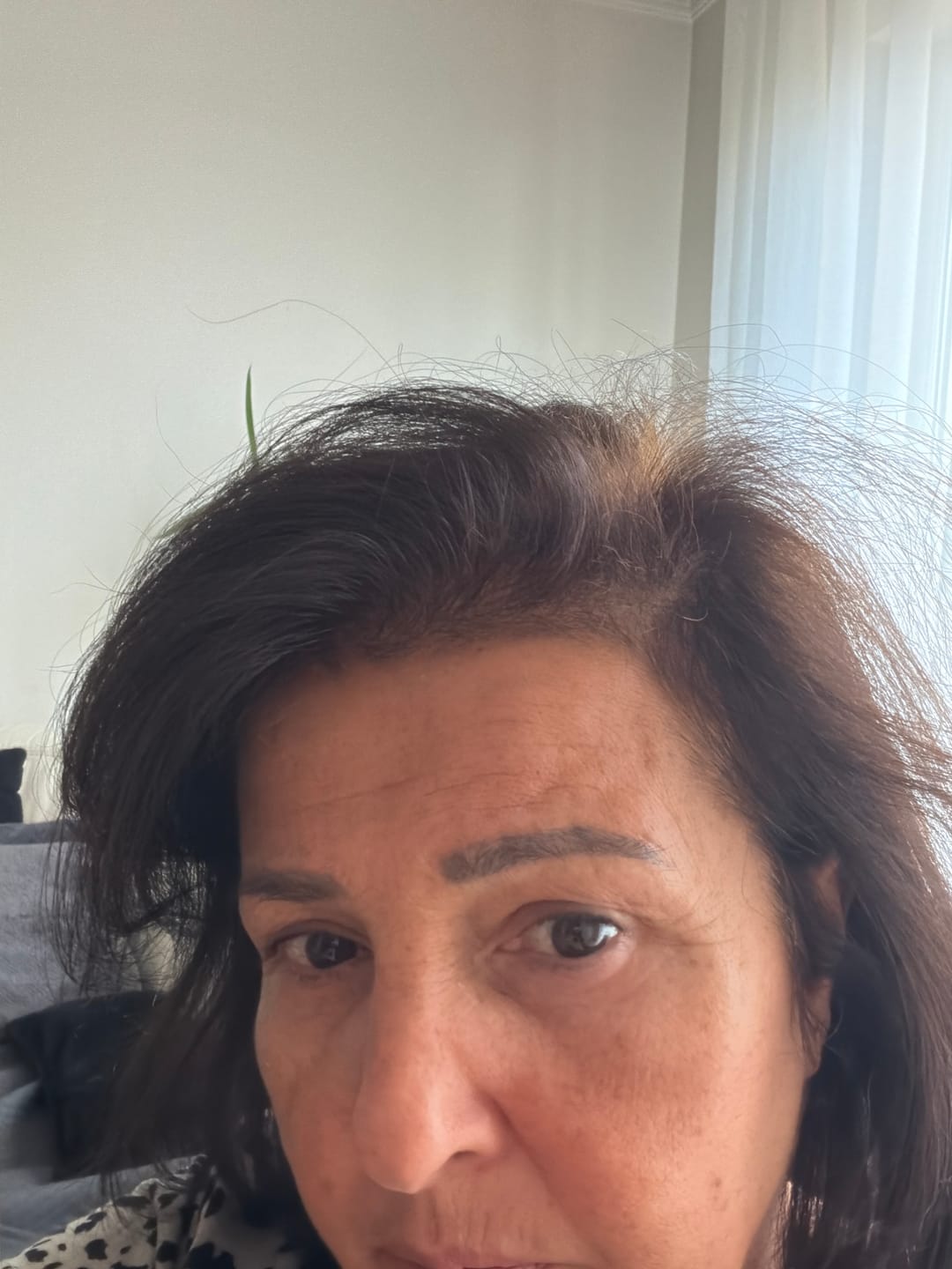Customer photo review of Duo Hair Women Anti-chute et Hair