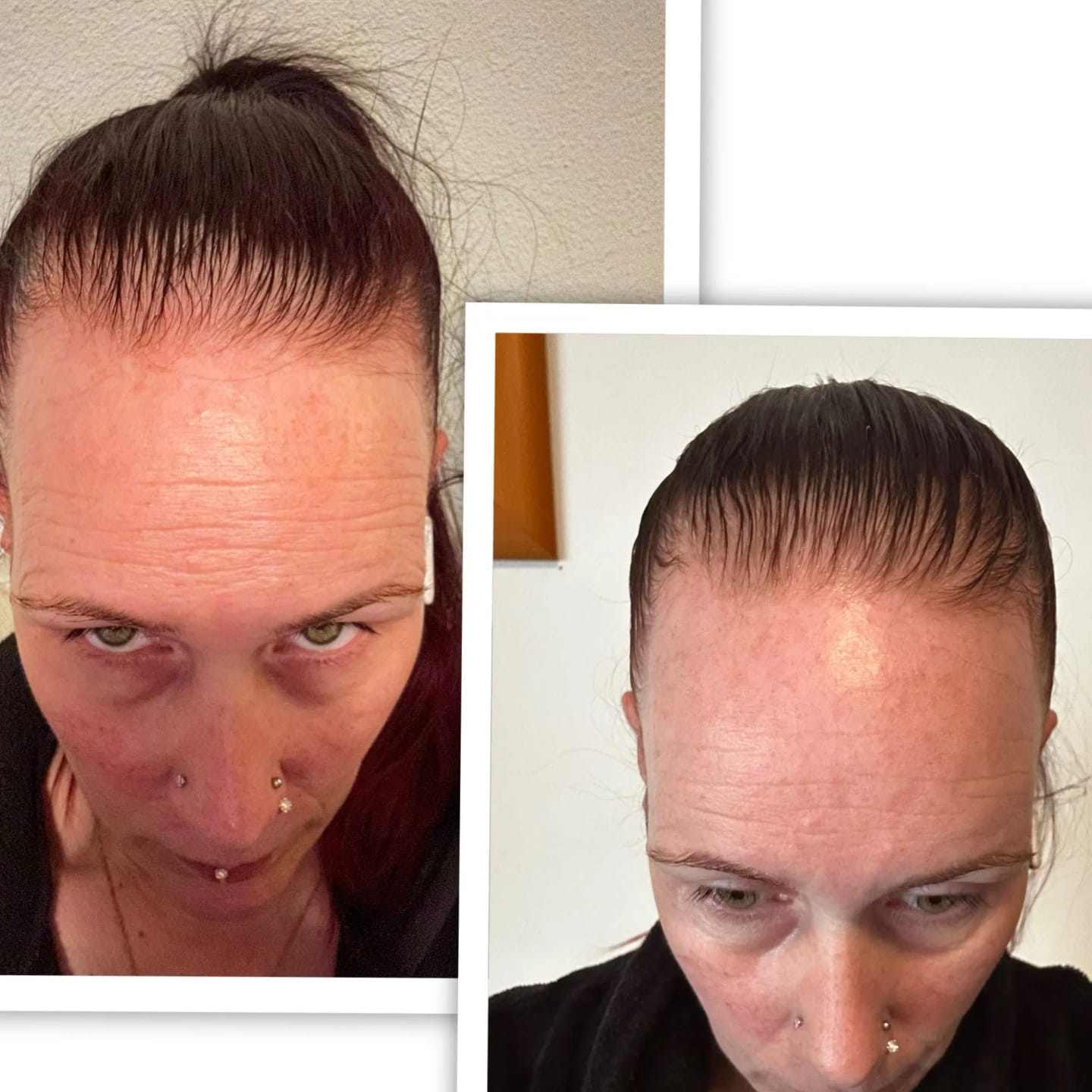 Customer photo review of AQUALYA Korean Hair Serum – Stronger-Looking Hair from the Roots