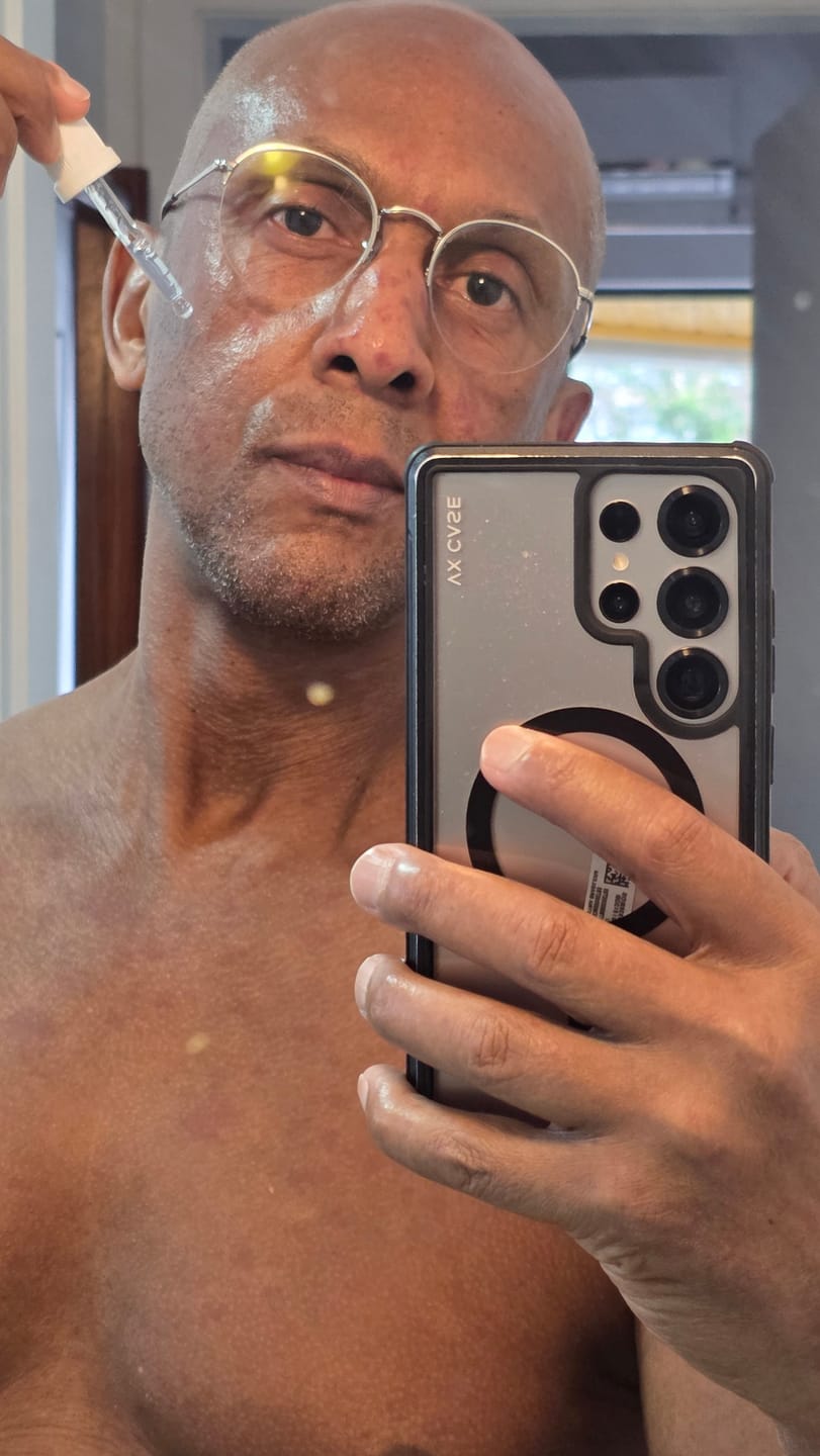 Customer photo review of Ultra Sérum Niacinamida