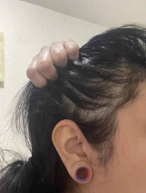 Customer photo review of AQUALYA Korean Hair Serum – Stronger-Looking Hair from the Roots