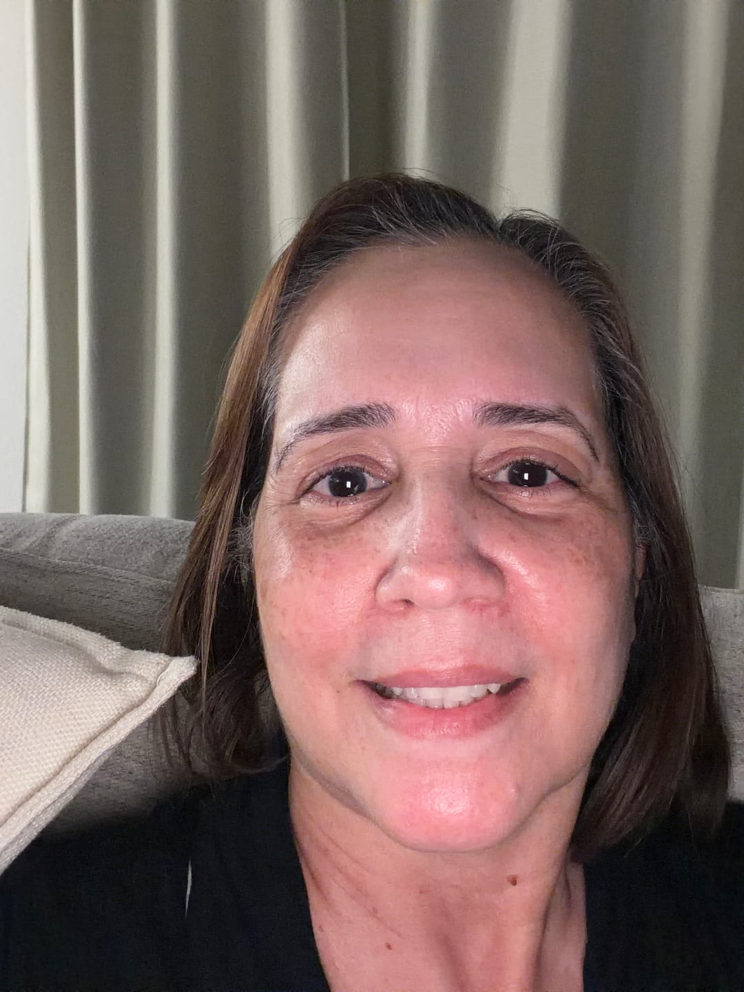 Customer photo review of CE SERUM | COMPLEXION BRIGHTENING