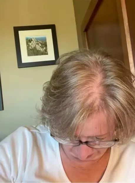 Customer photo review of AQUALYA Korean Hair Serum – Stronger-Looking Hair from the Roots