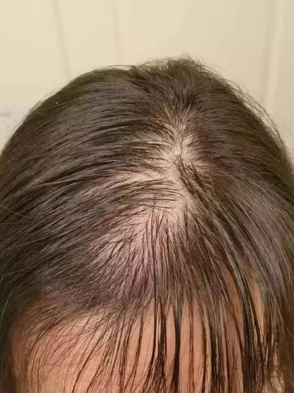 Customer photo review of AQUALYA Korean Hair Serum – Stronger-Looking Hair from the Roots