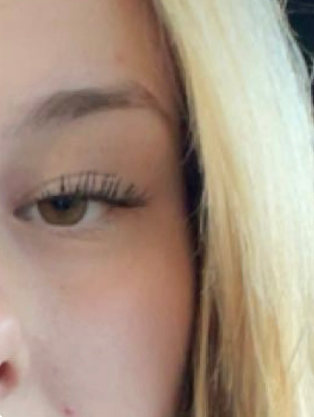 Customer photo review of Eyelash Growth Serum