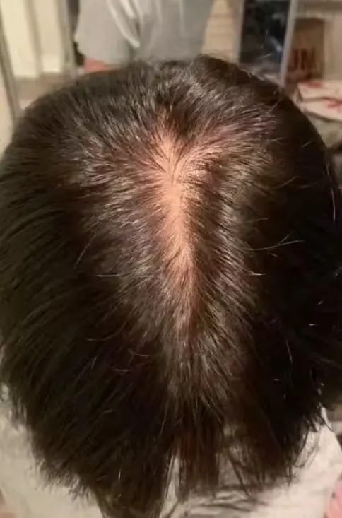 Customer photo review of AQUALYA Korean Hair Serum – Stronger-Looking Hair from the Roots