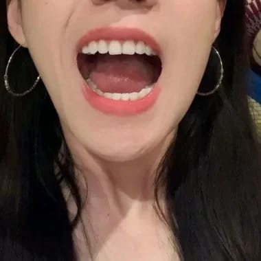 Customer photo review of Teeth Whitener – For a Brighter-Looking Smile
