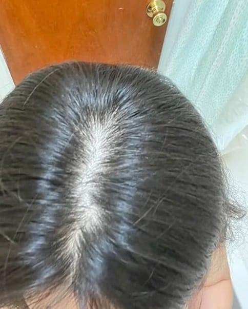 Customer photo review of AQUALYA Korean Hair Serum – Stronger-Looking Hair from the Roots