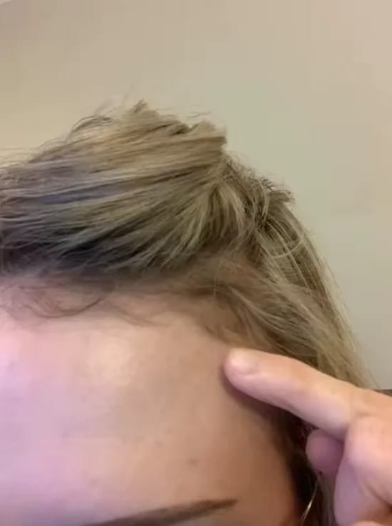 Customer photo review of AQUALYA Korean Hair Serum – Stronger-Looking Hair from the Roots
