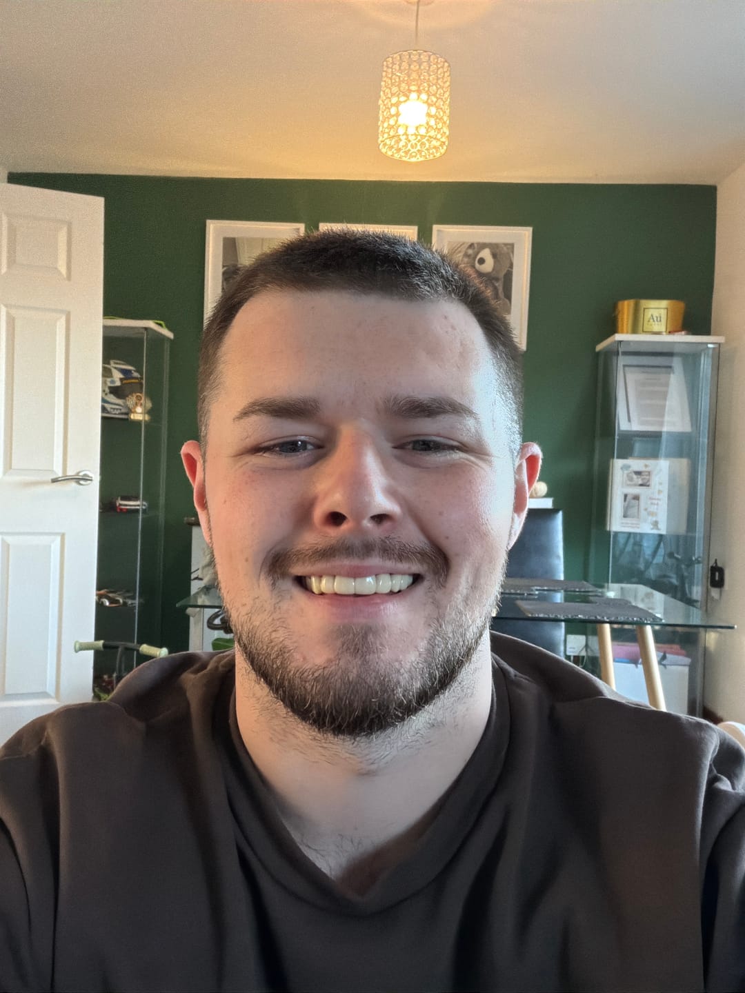 Customer photo review of Click-in Veneers 4.0