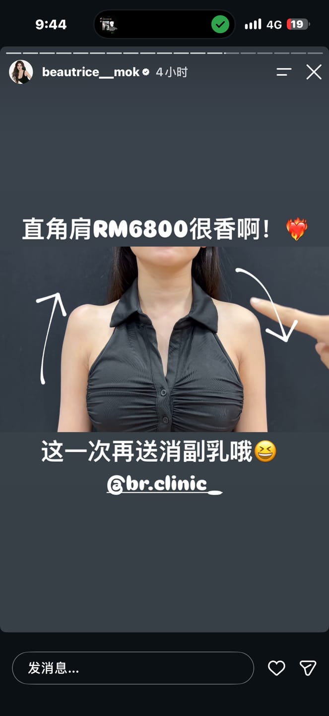 Customer photo review of Beautrice 十月开团:- Shoulder Contour Treatment (T&C applies)
