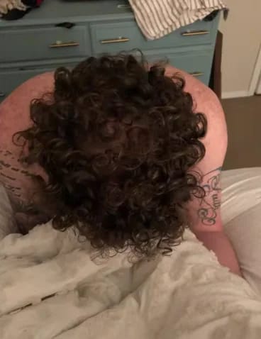 Customer photo review of AQUALYA Korean Hair Serum – Stronger-Looking Hair from the Roots