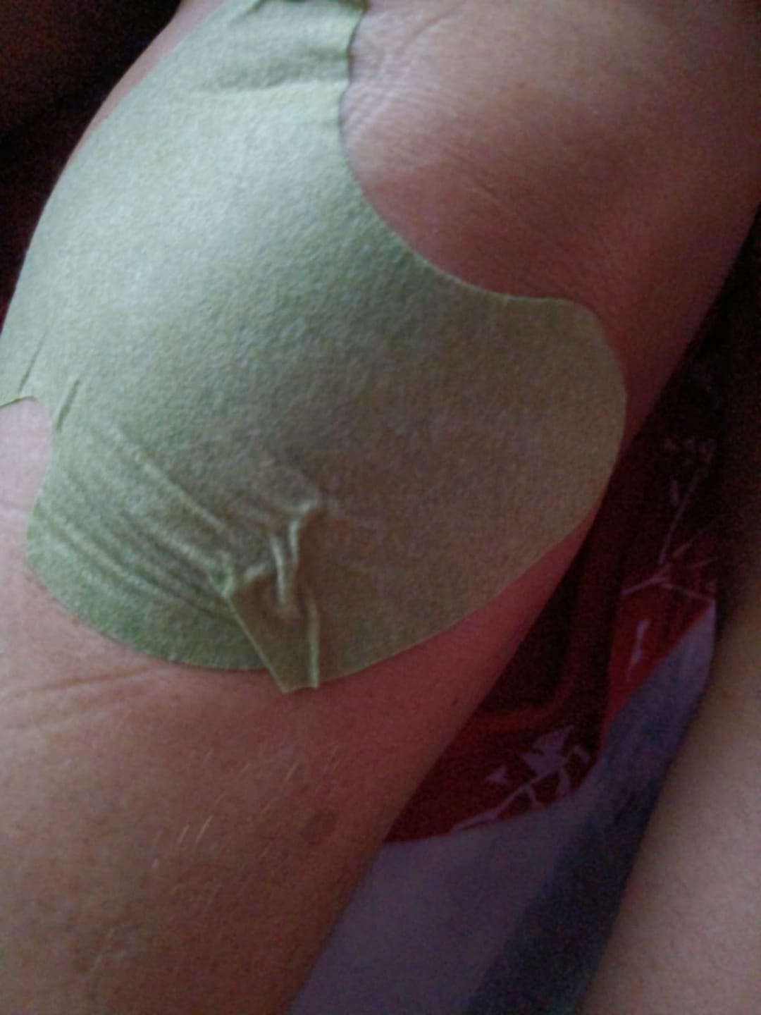 Customer photo review of Herbal Knee Pain Relief Patches