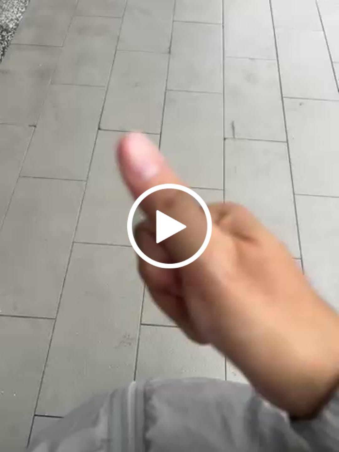 Customer video review of 30ml Topical Moisturising Lotion