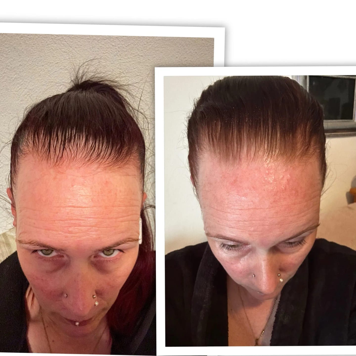 Customer photo review of AQUALYA Korean Hair Serum – Stronger-Looking Hair from the Roots