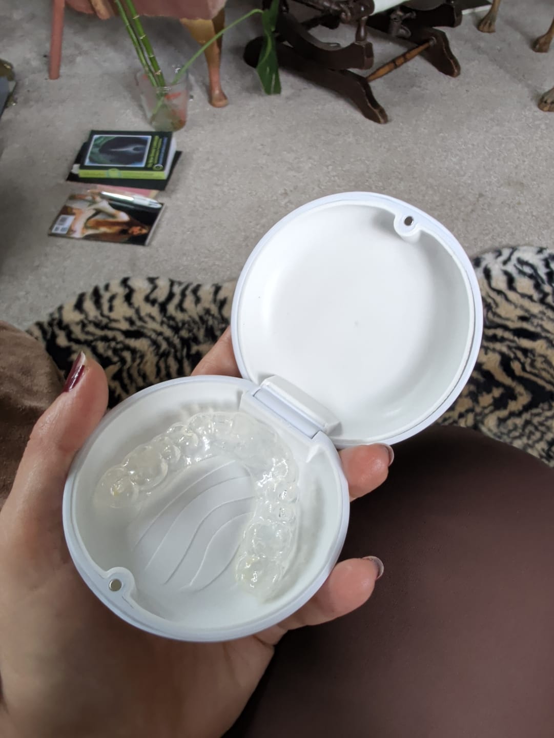 Customer photo review of 2.0mm Soft Day Guards
