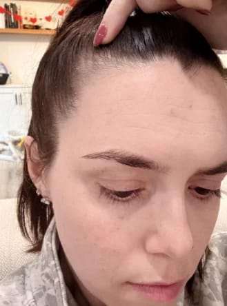 Customer photo review of AQUALYA Korean Hair Serum – Stronger-Looking Hair from the Roots