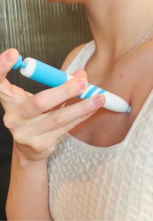 Customer photo review of Painless Skin Tag Removal Kit