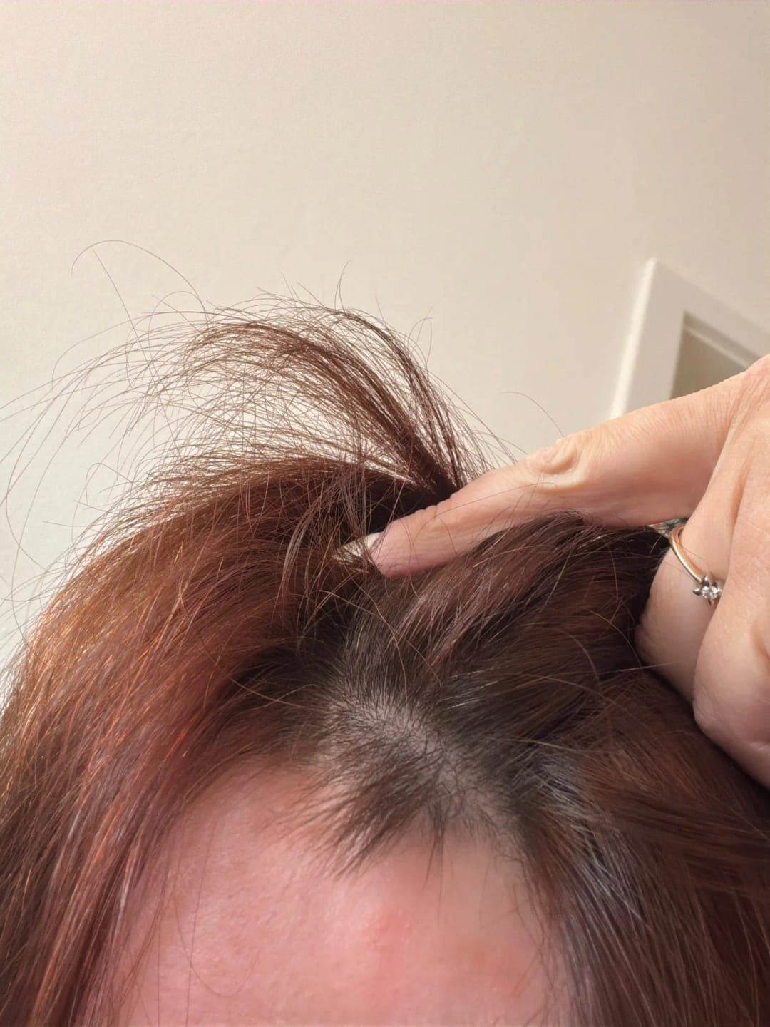 Customer photo review of AQUALYA Korean Hair Serum – Stronger-Looking Hair from the Roots