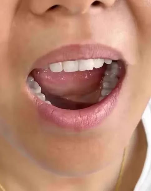 Customer photo review of Teeth Whitener – For a Brighter-Looking Smile