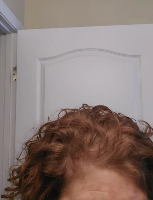 Customer photo review of AQUALYA Korean Hair Serum – Stronger-Looking Hair from the Roots