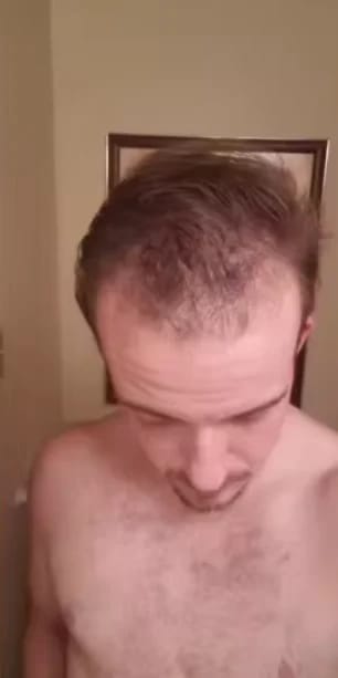 Customer photo review of AQUALYA Korean Hair Serum – Stronger-Looking Hair from the Roots